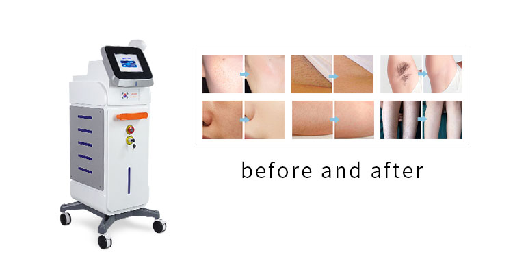 详情图03 详情图03