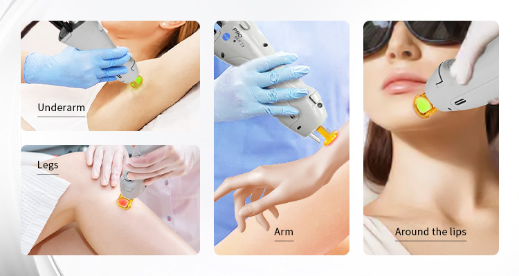 详情图06 详情图06