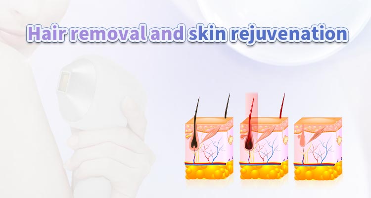 详情图06 详情图06