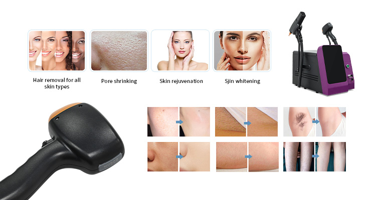 详情图06-2 详情图06-2