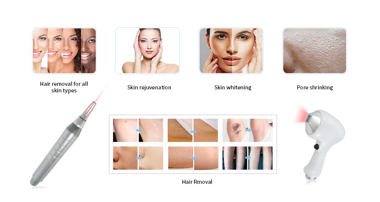 详情图02 详情图02