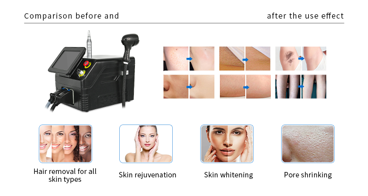 详情图03-1 详情图03-1