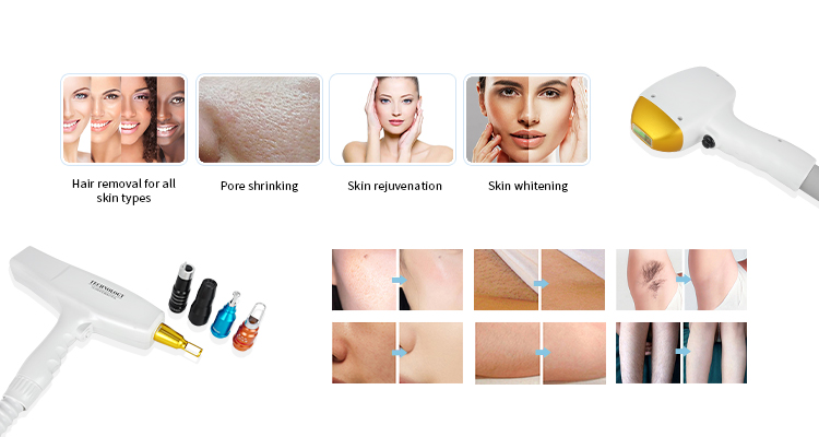 详情图02 详情图02