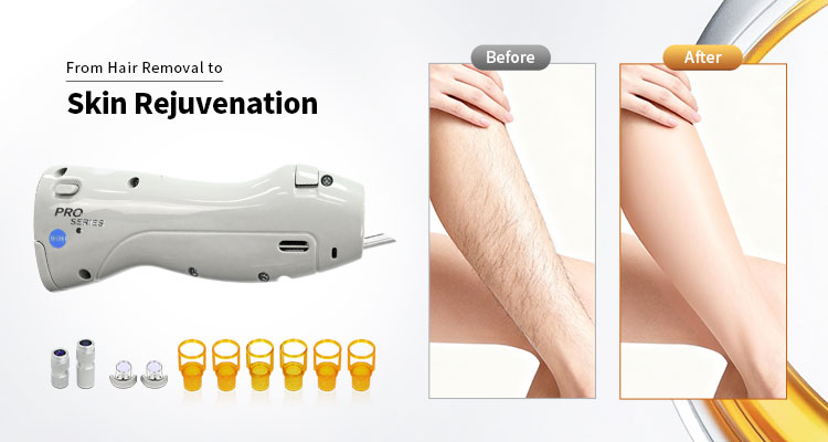 详情图05-1 详情图05-1