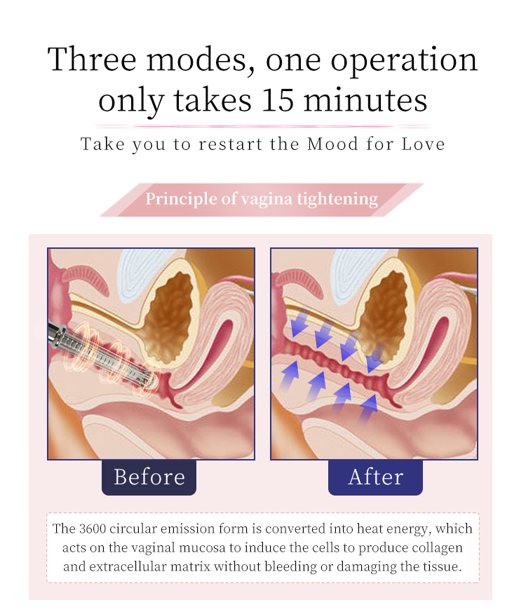 欧洲之星详情_09