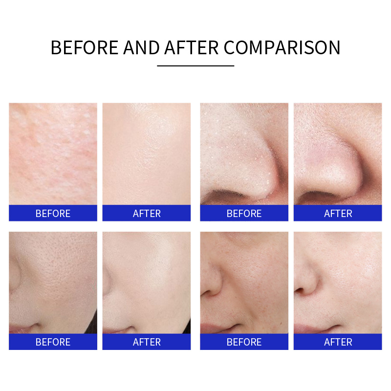 Diamond Peeling 3 In 1 Facial Care Machine Micro Dermabrasion Hydra Water Aqua Oxygen Jet Peel Beauty Machine Professional