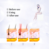 Professional 808nm Diode Laser Hair Removal Beauty Equipment Ice Cool Permanent Laser Depilator Epilation