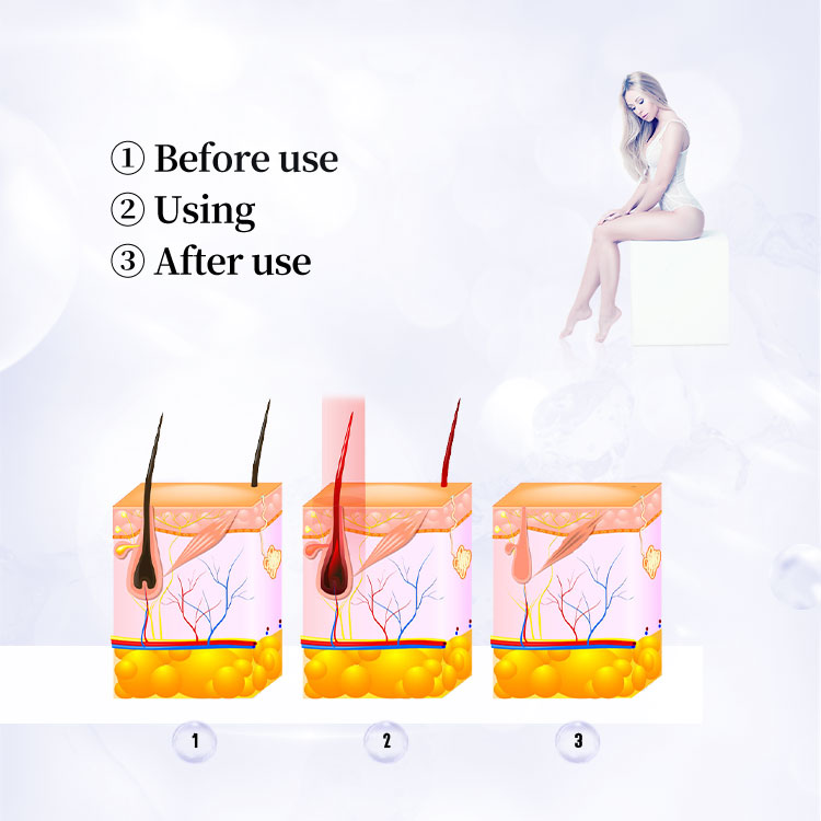 Professional 808nm Diode Laser Hair Removal Beauty Equipment Ice Cool Permanent Laser Depilator Epilation