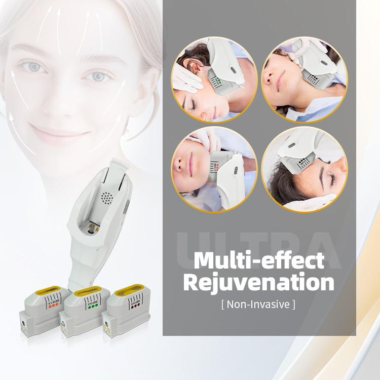10DHifu 2.0 Version Hefu High Intensity Ultrasound Technology Machine for Face Lifting Wrinkle Removal Slimming Portable